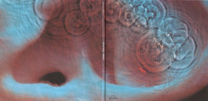 PINK FLOYD | MEDDLE (LP REPLICA DIGI)