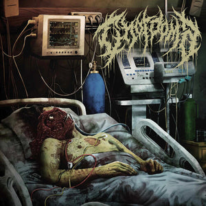 CHORDOMA | CHORDOMA