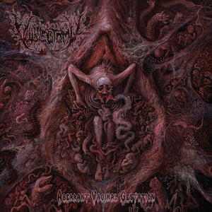 VULVECTOMY | ABERRANT VAGINAL GESTATION