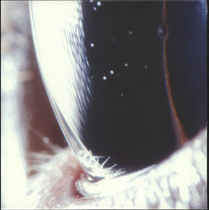 ROLY PORTER | THIRD LAW - 2LP 12"