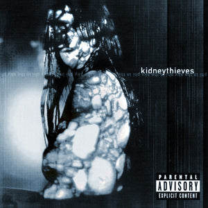 KIDNEYTHIEVES | PHI IN THE SKY